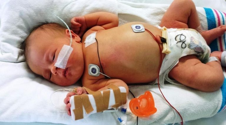 Has Your Baby Suffered a Birth Injury?